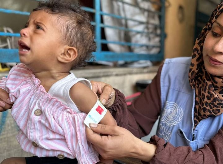 A UNRWA worker in Gaza checks a child for signs of malnutrition.